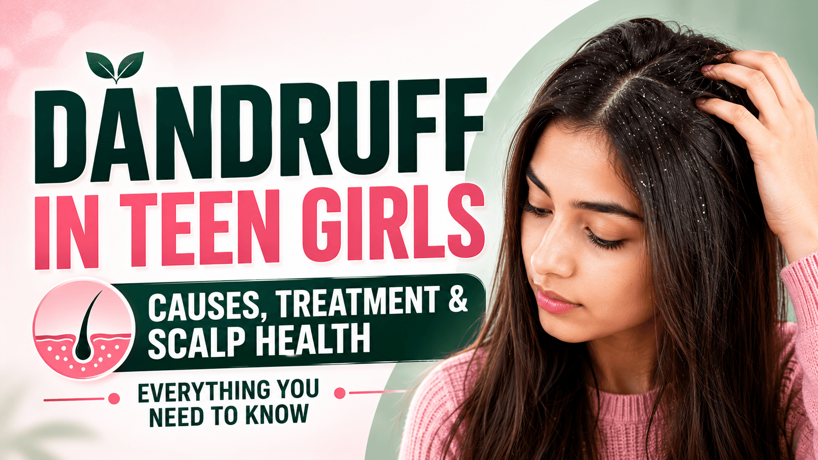 Dandruff in Teen Girls: Causes, Treatment, and Scalp Health